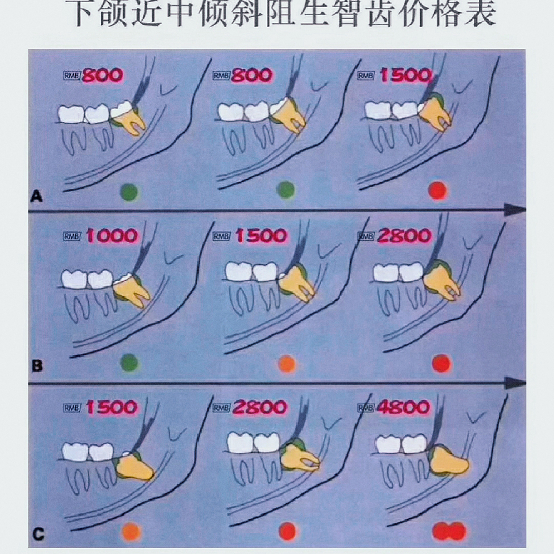 拔智齒收費(fèi)標(biāo)準(zhǔn)的全面解析，拔智齒收費(fèi)標(biāo)準(zhǔn)的深度解析與探討