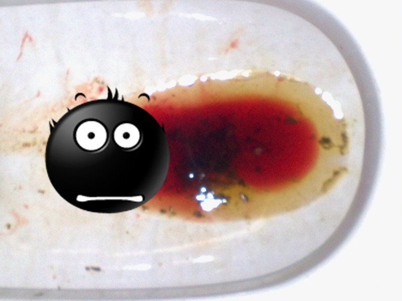 拉屎出血但不疼，原因分析及應(yīng)對措施，拉屎出血但不疼，原因解析與應(yīng)對策略