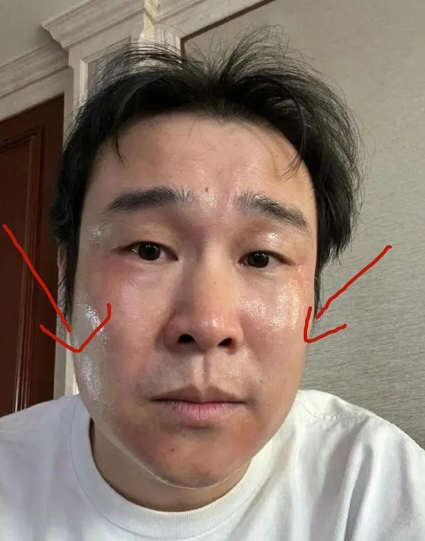 頭痛欲裂，感覺要爆炸了怎么辦？全面解析頭痛原因與應(yīng)對之策，頭痛欲裂，緊急解析原因與應(yīng)對之策，全面攻略助你擺脫頭痛困擾