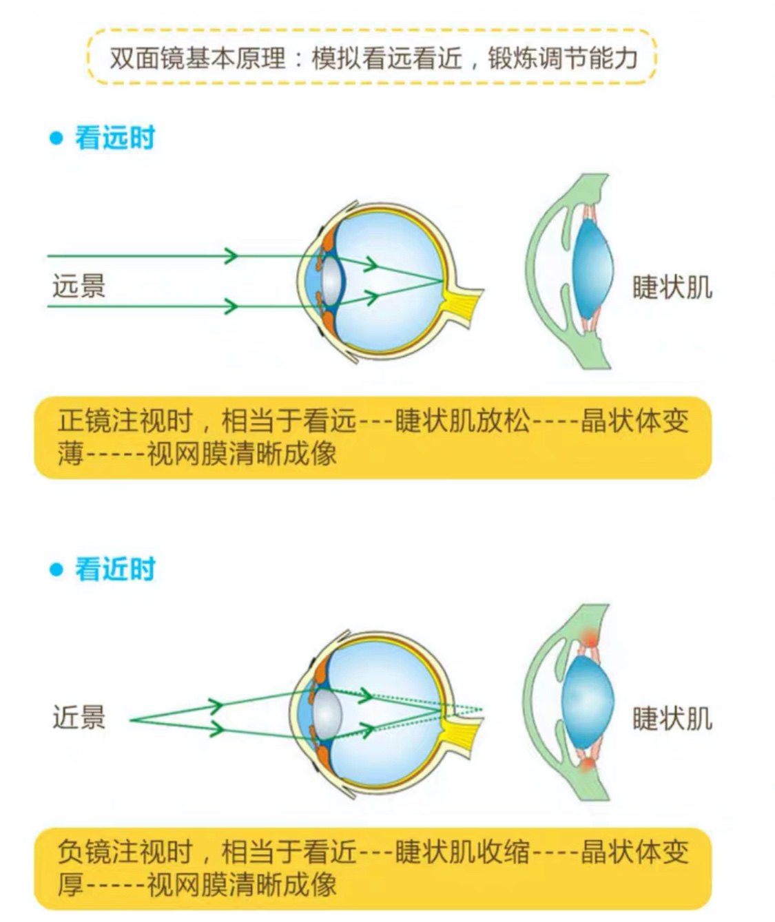 糾正眼睛近視的有效辦法，糾正眼睛近視的有效方法總結(jié)