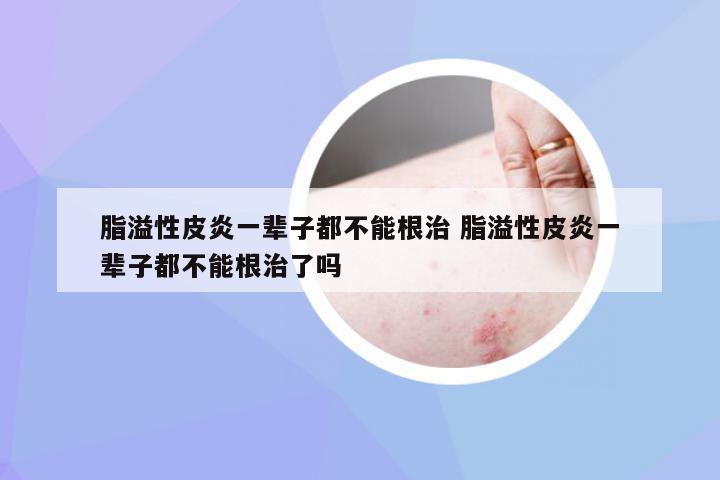 脂溢性皮炎，并非終身無法根治的疾病，脂溢性皮炎并非無法根治，治療策略助你擺脫困擾